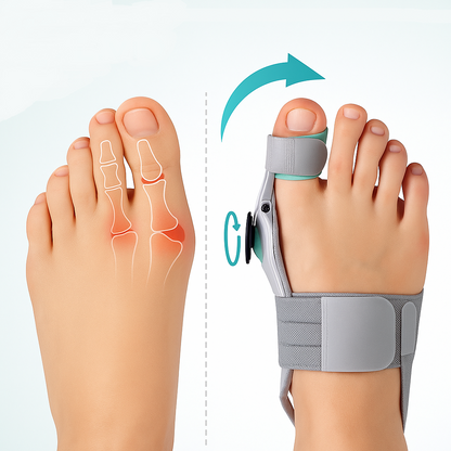 Relivio™ Bunion Corrector – Natural Relief & Toe Alignment for Everyday Comfort